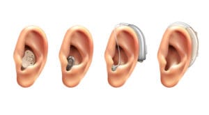 Top Hearing Aids