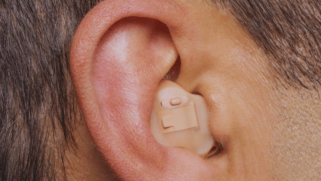 In the Ear Hearing Aids