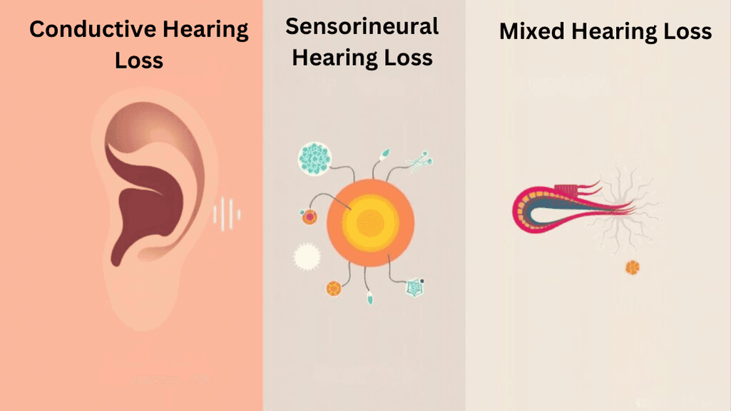 Types of hearing loss