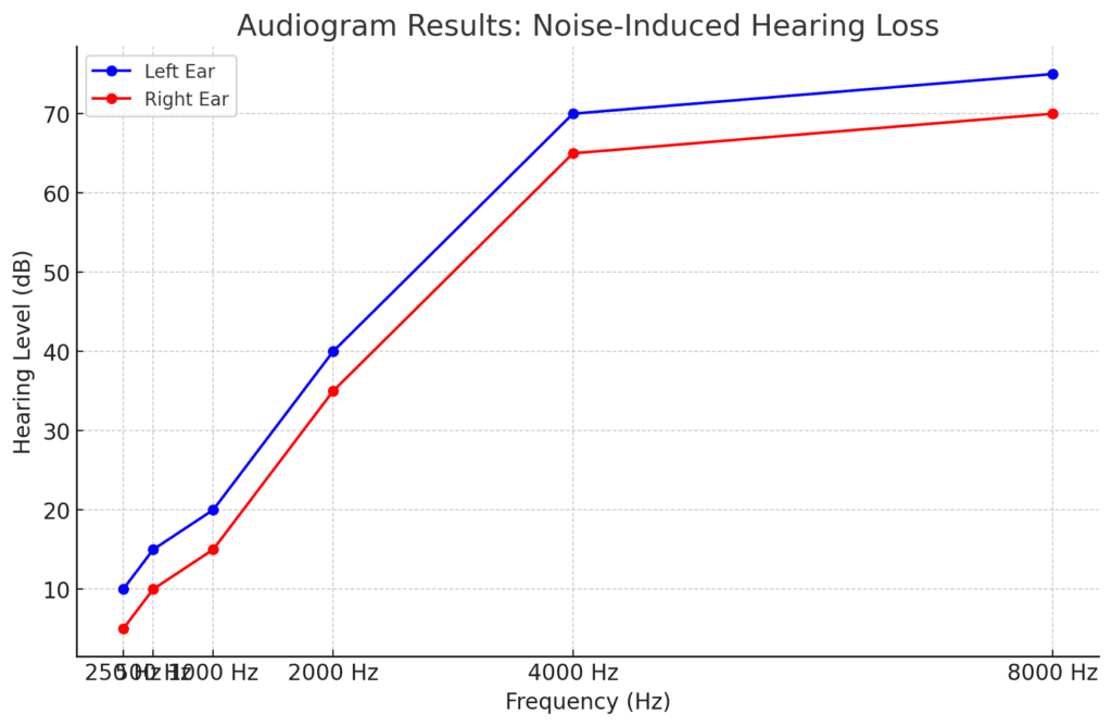 Interpreting audiogram NIHL results